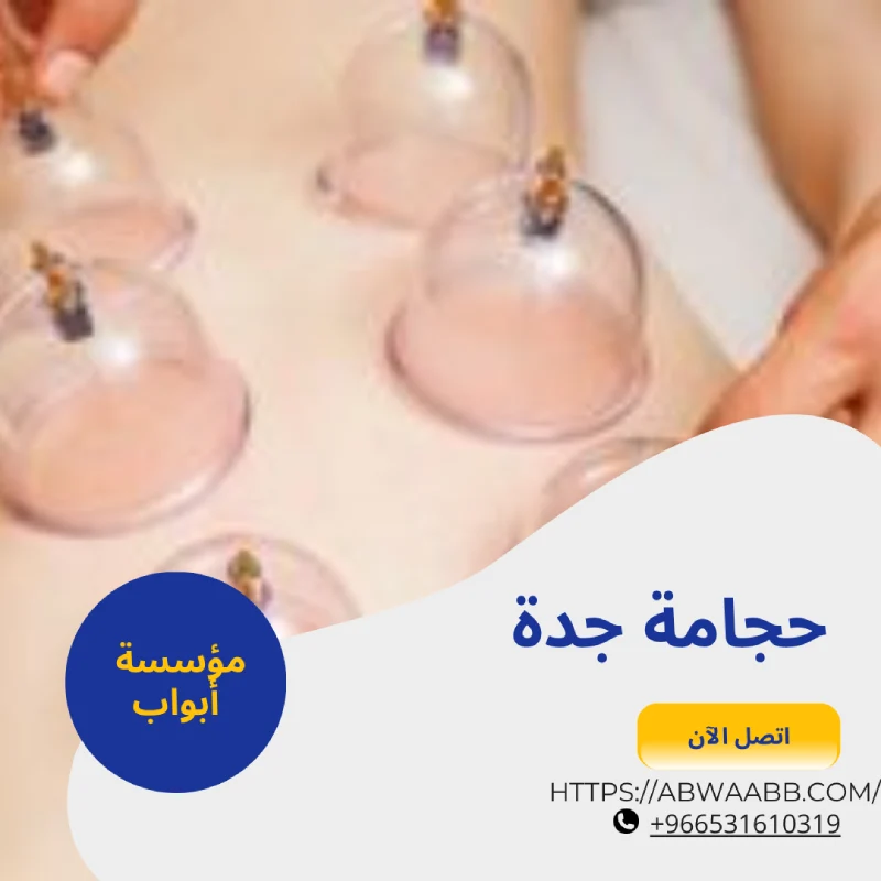حجامة جدة