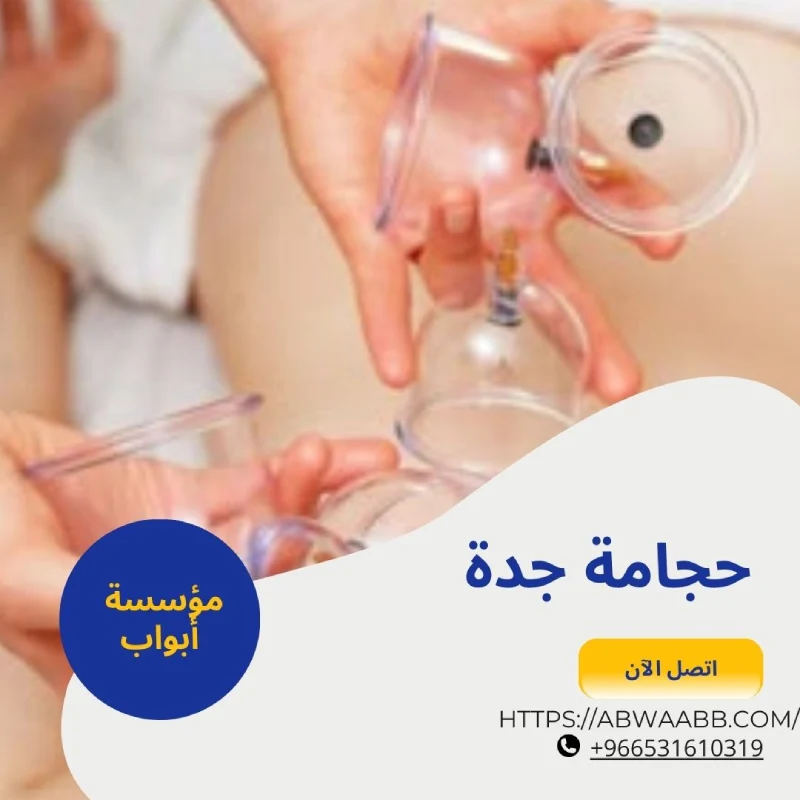حجامة جدة