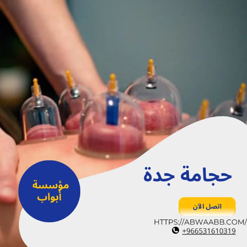 حجامة جدة