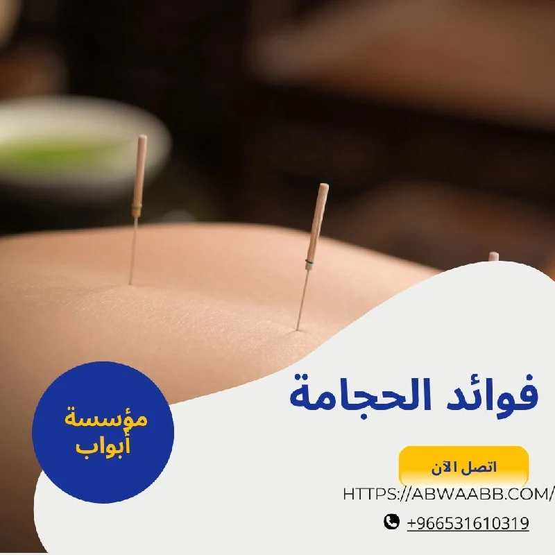فوائد الحجامة