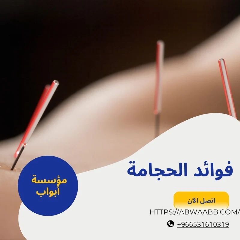 فوائد الحجامة