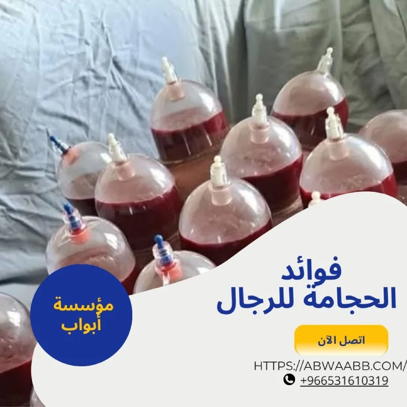 فوائد الحجامة للرجال