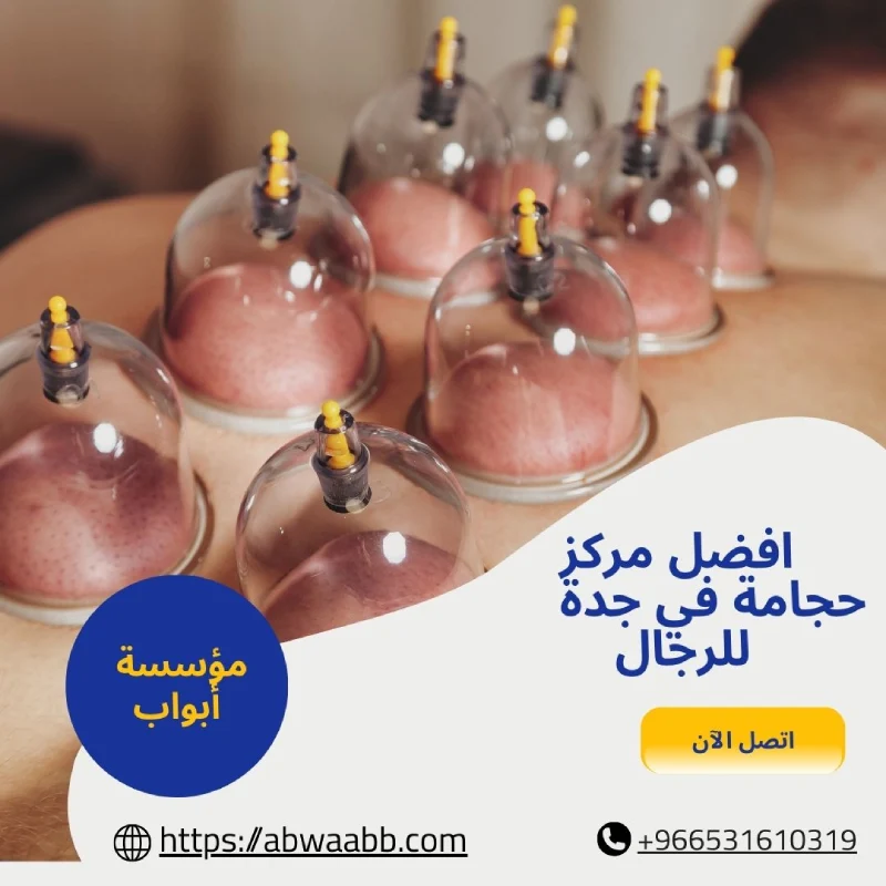 افضل مركز حجامة في جدة للرجال